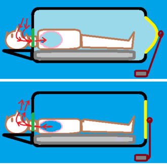 Diagram demonstrating the mechanical operation of an iron lung.